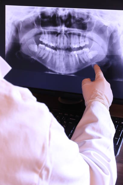 Best Emergency Tooth Extraction in Citrus, CA
